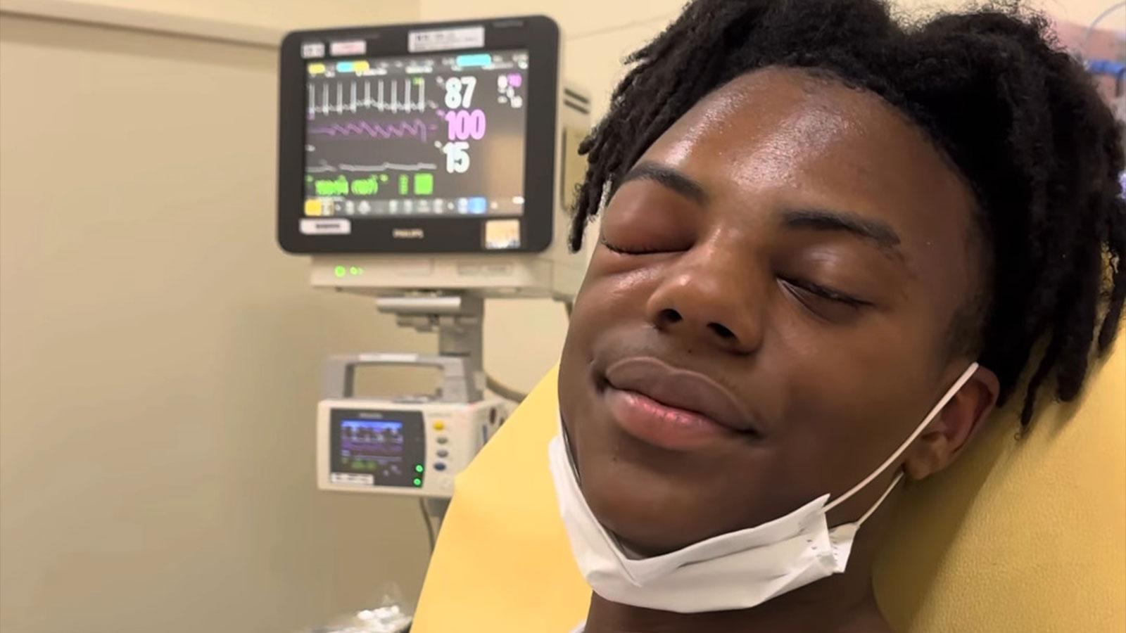 IShowSpeed lay in a hospital bed with a swollen right-eye